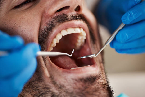 Best Broken or Cracked Tooth Emergency Dentist in Palestine, IL