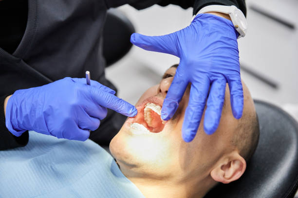 Best Emergency Dental Extractions in Palestine, IL